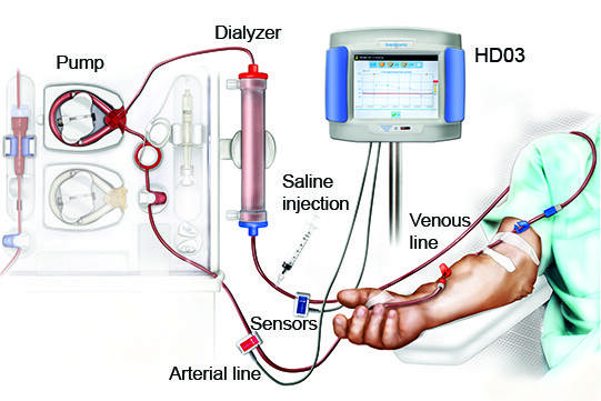 Transonic HD03 