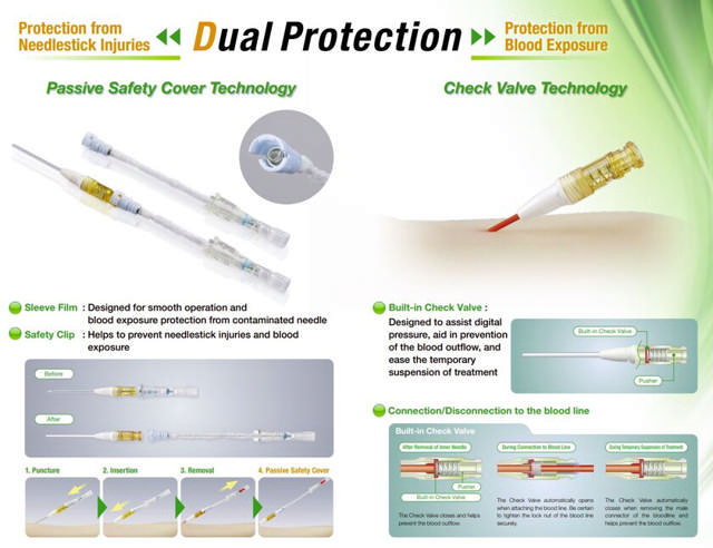 SuperCath PRO, 15G, 33 mm (50 stk. pr. box)